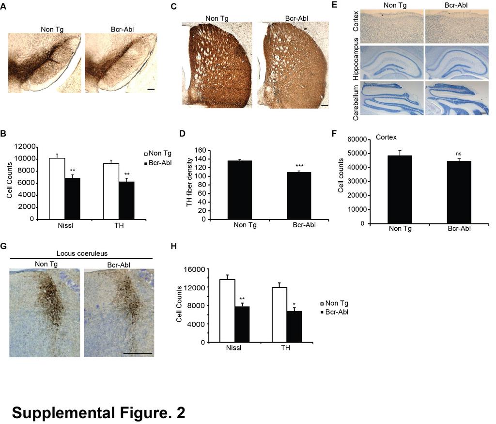 Supplemental Figure 2. Transgenic mice overexpressing Bcr-Abl exhibit nigral dopamine degeneration, degeneration of TH-positive neurons in the locus coeruleus and toxic accumulation of α-synuclein.