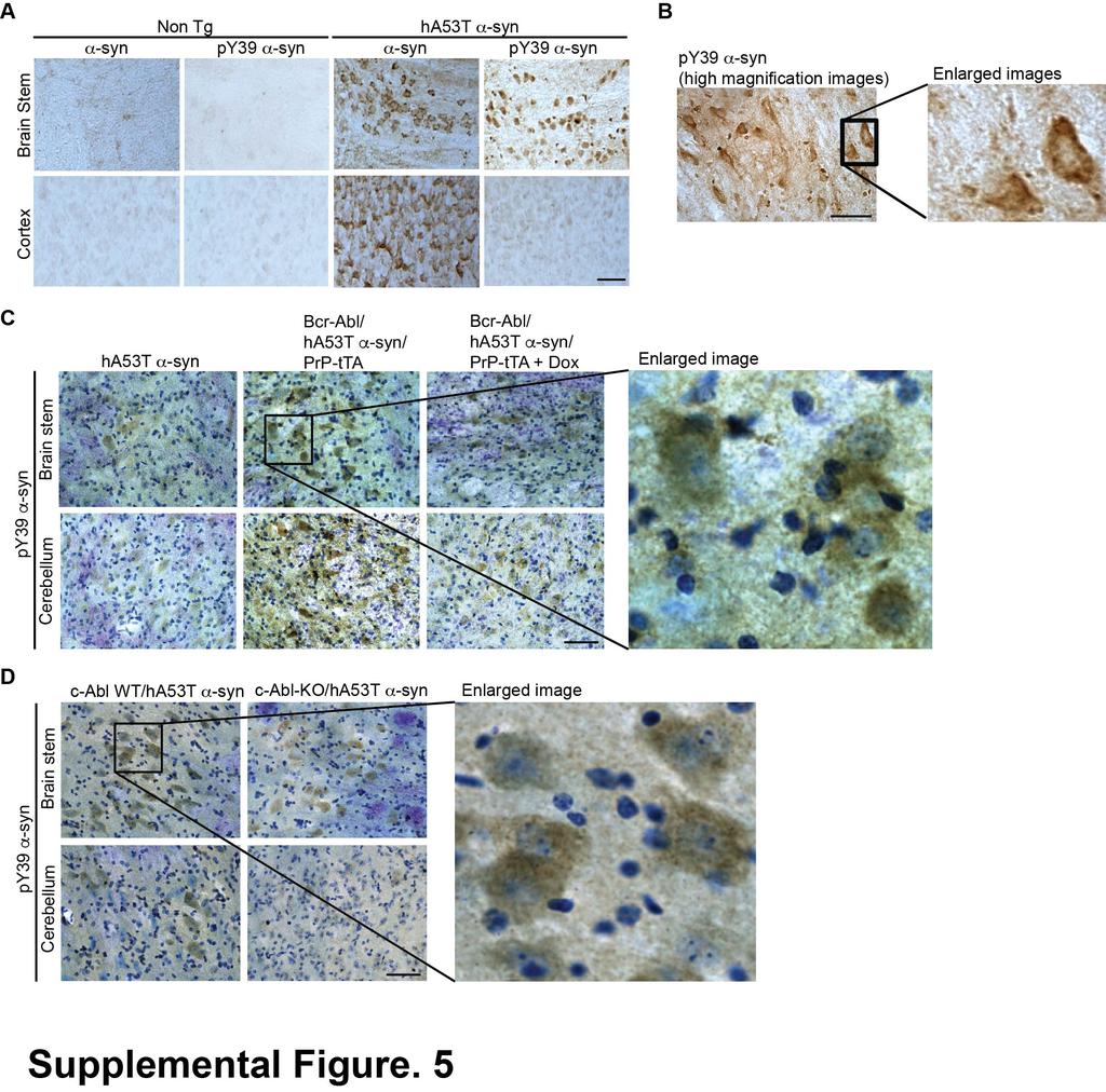 Supplemental Figure 5. Immunohistochemical evaluation of phospho-y39 α- synuclein expression in mice.