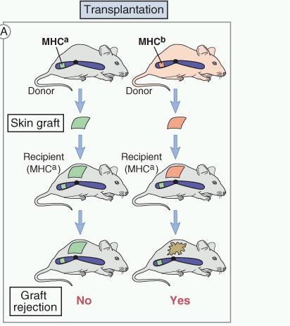 Discovery of Human MHC Recognition of a graft as self or foreign is an inherited trait histocompatibility genes: