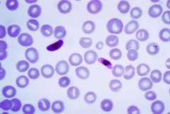 CLASSIFICATION OF PARASITES General classification: animal parasites are classified according to