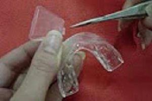 Step 16 : After molding both trays, use scissors to cut any excess material from the gum line.