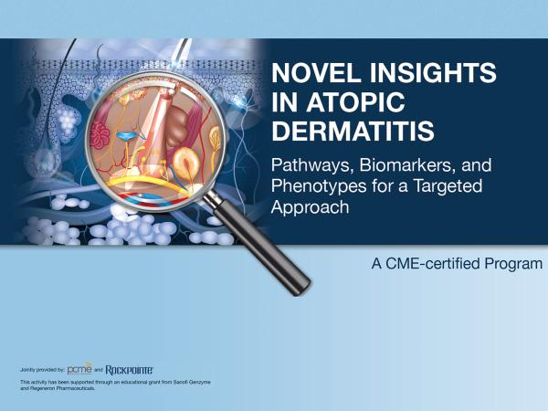 Novel Insights in Atopic Dermatitis: Pathways, Biomarkers, and Phenotypes for a Targeted Approach Transcript Title Slide Welcome to the CME-certified program: Novel Insights in Atopic Dermatitis;