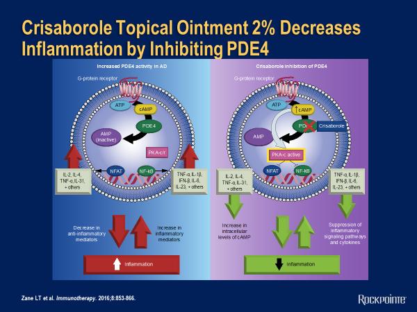 Crisaborole Topical Ointment 2% Decreases Inflammation by Inhibiting PDE4 Crisaborole, a recently approved topical ointment, looks at the PDE4 pathway.
