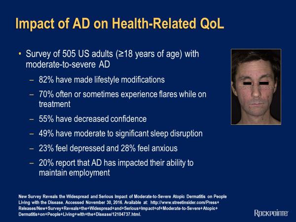 Impact of AD on HRQoL Atopic dermatitis has a number of effects on health-related quality of life.