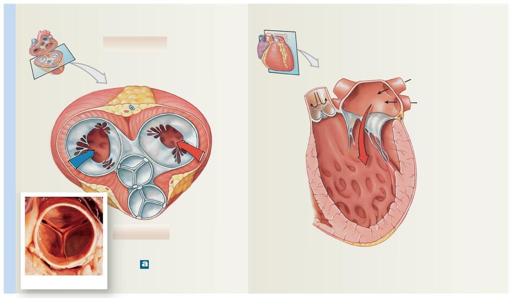 Figure 12-6a The Valves of the Heart.