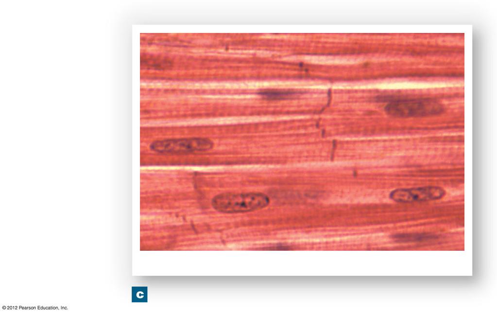 Figure 20-5c Cardiac Muscle Cells Intercalated