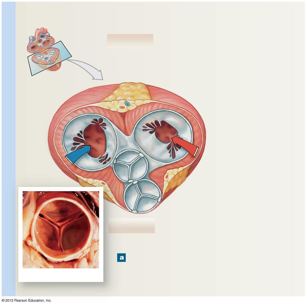 Figure 20-8a Valves of the Heart Transverse Sections, Superior View, Atria and Vessels Removed POSTERIOR Cardiac skeleton Left AV (bicuspid) valve (open) RIGHT VENTRICLE LEFT VENTRICLE Relaxed
