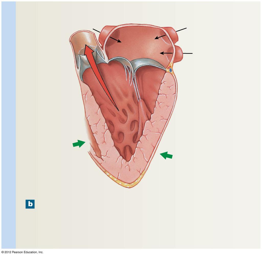 Figure 20-8b Valves of the Heart Contracting ventricles Aorta Aortic sinus Aortic valve (open) LEFT ATRIUM Left