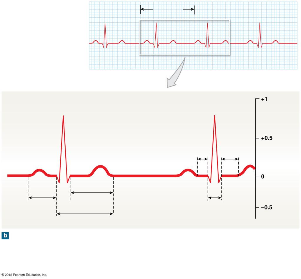 Figure 20-13b An Electrocardiogram 800 msec R R P wave (atria depolarize) T wave (ventricles repolarize) P R