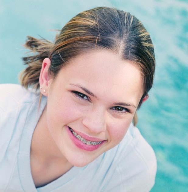Benefits Overview Orthodontic Benefit ORTHODONTIC SERVICES No deductible Children up to 18 th birthday Plan