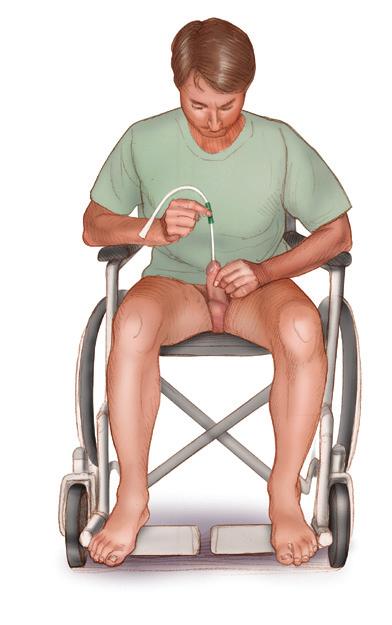 If you are in a wheelchair your specialist nurse will advise you on how ISC can be adapted for your particular needs. Never strain to empty your bladder.