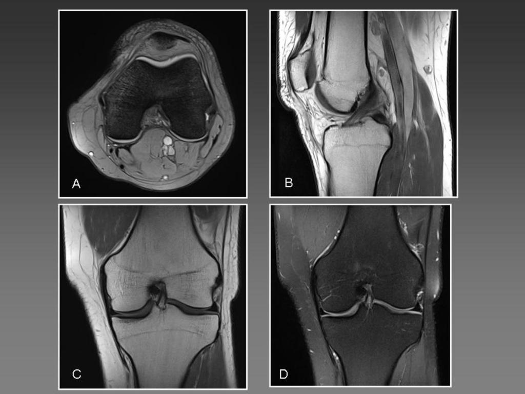 Fig. 9: MRI. Standardized knee study.