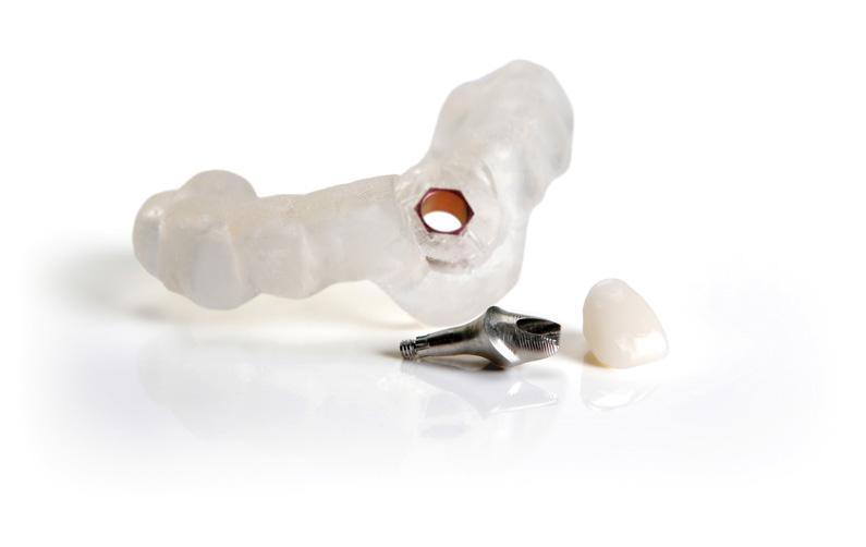 Confident implant placement Simplant guides take Simplant diagnostics to another dimension.