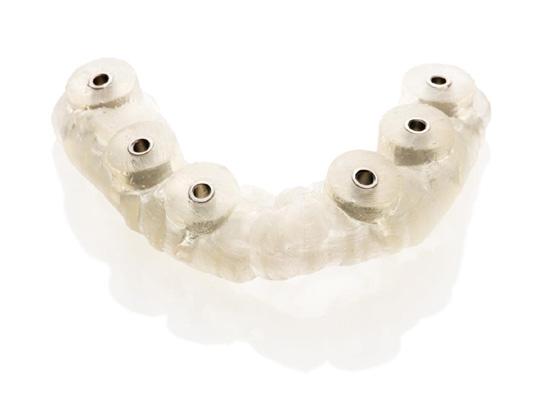 Immediate Smile featuring Atlantis Abutment Rotational transfer is available in the Simplant Guide, when individualized esthetics are to be delivered.