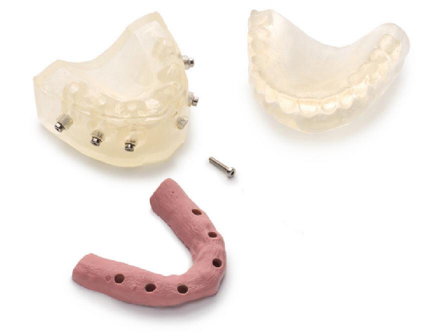 Zimmer Dental and more. * Unique for Ankylos, Astra Tech Implant System EV and Xive implants.