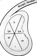 Arthroscopic Shoulder Evaluation Anterior inferior (Bankart) Posterior (reverse Bankart) Posterior superior (Internal impingement) Anterior superior (Andrews)