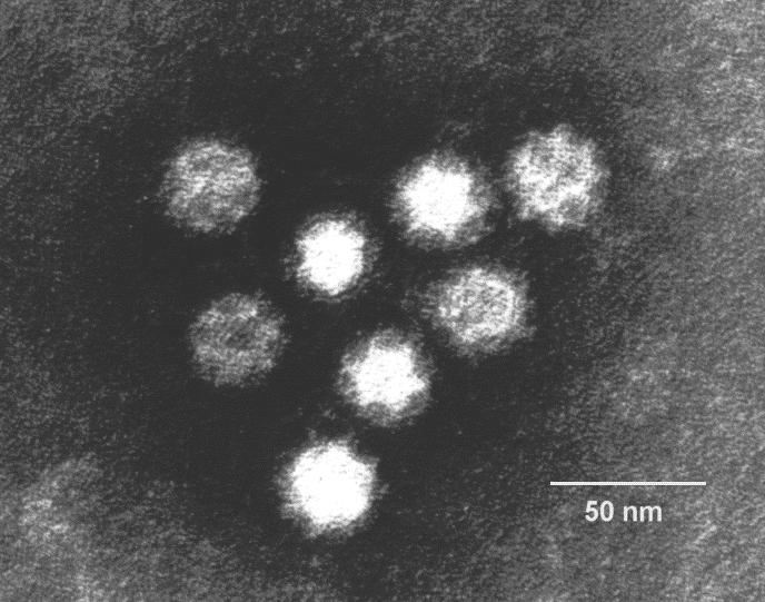 Family Caliciviridae Nonenveloped icosahedral particles (27-34nm) single capsid protein (58-60kDa) ss positive