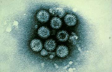 Viral agents of gastroenteritis Many viruses identified which cause diarrhoea in humans.