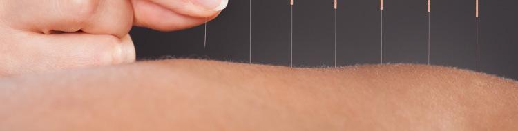 It is also said to boost lymphatic system to carry away toxins Over 3 million Americans use acupuncture.