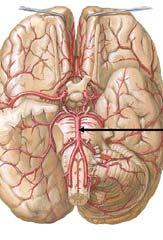 Vertebral Artery Basilar Artery Posterior Circulation (Back of Brain) The Right and