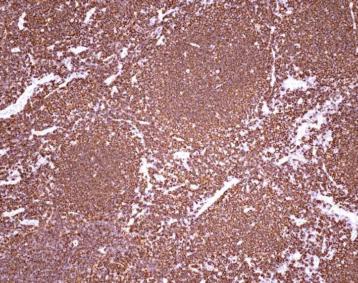 Label tumour cells in interfollicular