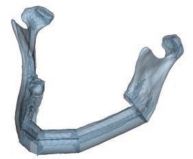 Product Information Osteotomy