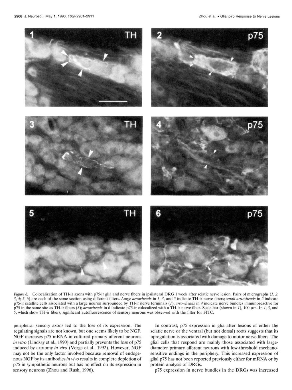 2908 J. Neurosci., May 1, 1996, 76(9):2901-2911 Zhou et al.. GIlal p75 Response to Nerve 1 -esions Figure 8.