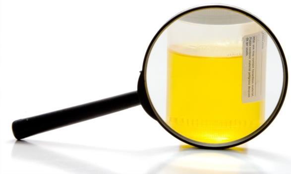 Validation Patients may tamper with urine samples to hide aberrant behaviours by: adding adulterants diluting the sample substituting another individuals sample for their own ingesting excessive
