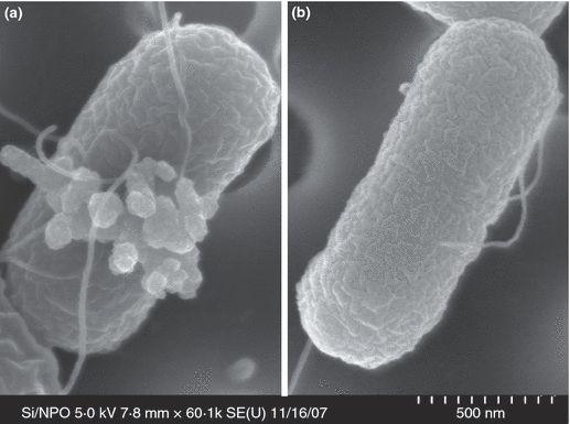 Scanning electron microscope images of E.
