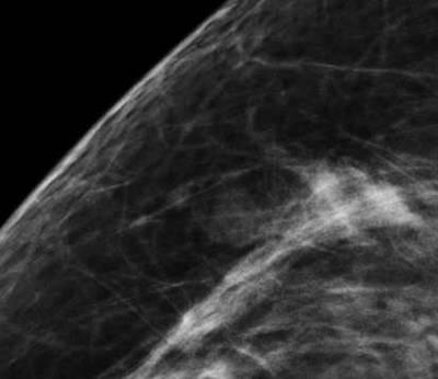 376 Mammography Recent Advances Fig. 2.