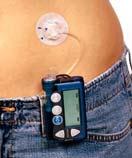 INSULIN PUMPS Continuous infusion of insulin lispro, aspart, or glulisine via subcutaneous cannula Lower