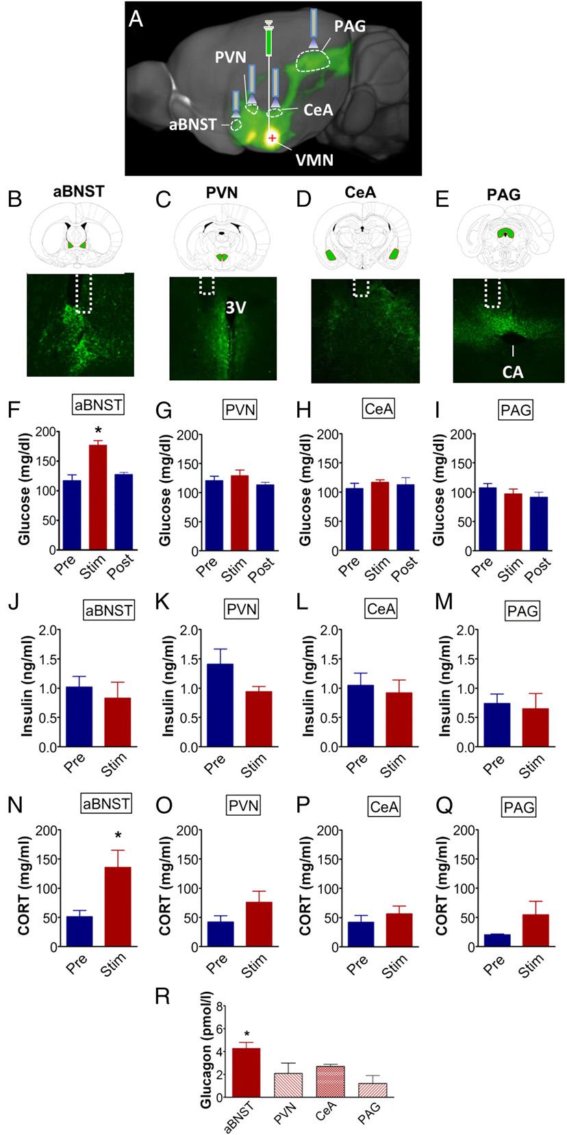 Fig. 5. Photoactivation of VMN SF1 abnst projections selectively promote hyperglycemia in nondiabetic mice.