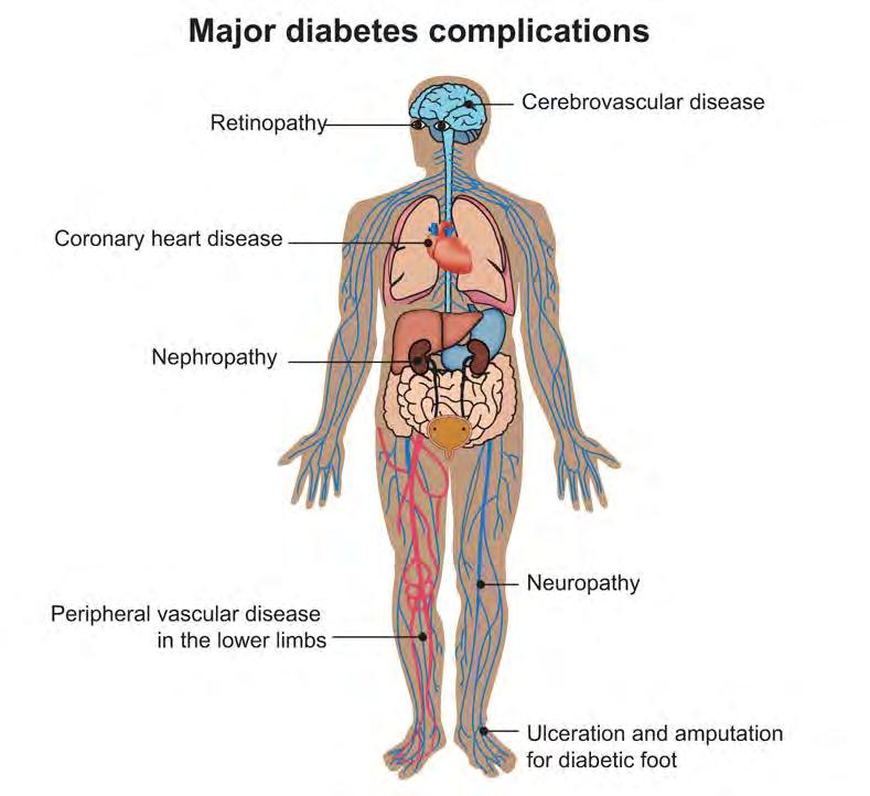 unmanaged diabetes leads to health complications ER visit w/o hospitalization Top 2 causes are hypoglycemia & diabetes related Hypertension 71% of people with diabetes Heart Attack 1.
