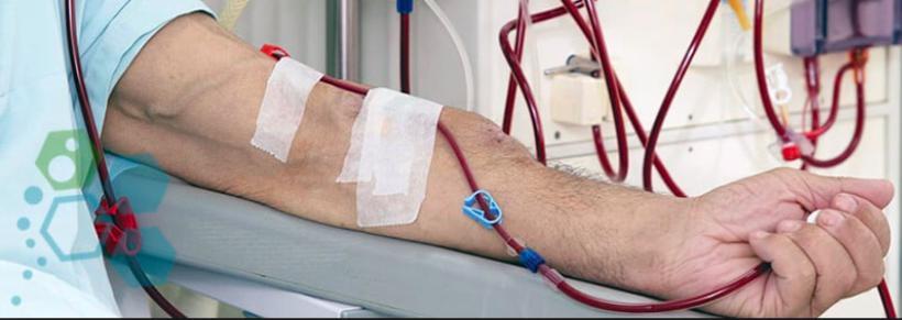 Aftermath of Kidney Failure Dialysis 3-4 hour treatments, 3-4 days per week