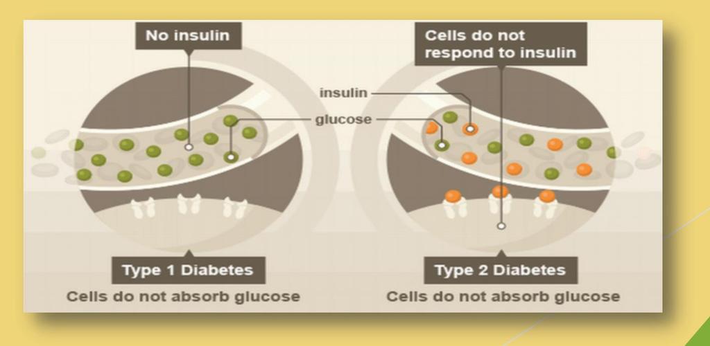 Mechanisms of Diabetes Diabetes is due to one of two mechanisms: 1.