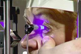 loss of peripheral vision, halo around light Diagnosed: Tonometer (measures