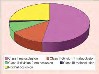 WJD A Study to determine the Prevalence of Malocclusion and Chief Motivational Factor for Desire of Orthodontic Treatment dental esthetic reasons, facial appearance reasons, speech and periodontal