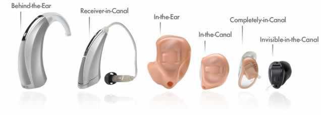 Management of hearing loss Conductive hearing loss Correction of pathology if possible Sensori-neural hearing loss Counselling and