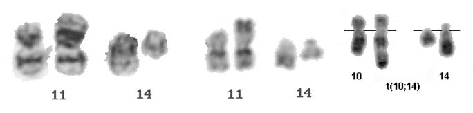 razne strukturne promjene 11q, 12p ili kromosoma 3.