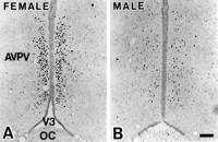 In rats, AVPV is larger in females than in males.