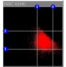 The RBC Method ADVIA Volume/Hemoglobin Concentration (V/HC) cytogram C e ll v o l u m e 1.