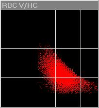 RBC Cytogram: Visual Analysis (ADVIA) Normal