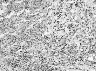 2012 Mar 28;4(127):127ra37.  Regional expression + TILS Inducible expression Drivers of expression in melanoma Sci TranslMed.