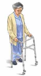 After Hip Replacement: Walking Step 1 Place the walker a few inches in front on you and hold on to the walker firmly with both