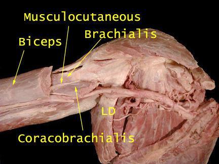 Branches of the lateral cord Musculocutaneous