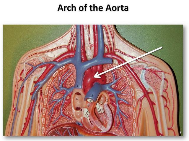 left pulmonary artery inferior surface