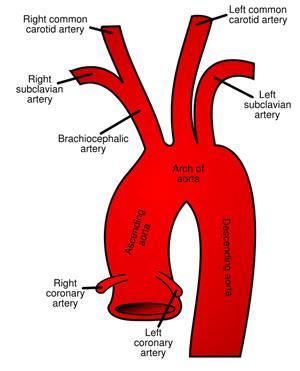first and largest branch of the arch of the aorta arises posterior to the manubrium.