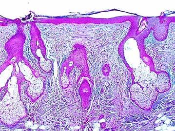 Sebaceous glands Sebaceous follicle What to look for: Associated with hair follicle Found most