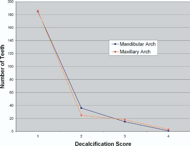 208 Ghiz et al American Journal of Orthodontics and Dentofacial Orthopedics February 2009 Decalcification Score: Score 1 Score 2 Score 3 Score 4 Score 1 = No decalcification Score 2 = Slight