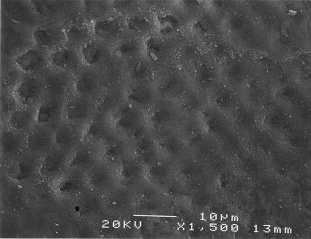 210 Ghiz et al American Journal of Orthodontics and Dentofacial Orthopedics February 2009 Fig 8. SEM photograph of pumiced enamel surface (1500 times magnification). Fig 10.